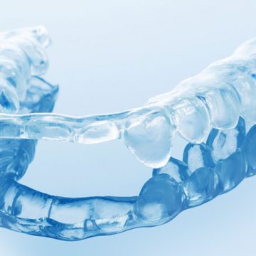 All You Should Know about the Use of Night Guards in Dentistry