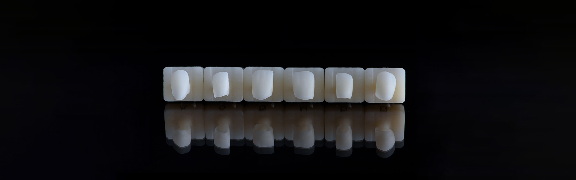 How Can Cosmetic Veneers Reduce Your Gummy Smile?