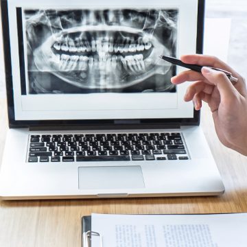 Are Routine Dental X-rays Important?