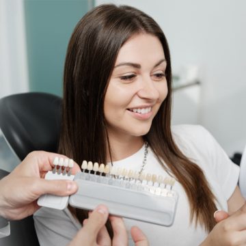 What are Dental Veneers: Step-by-Step Procedure