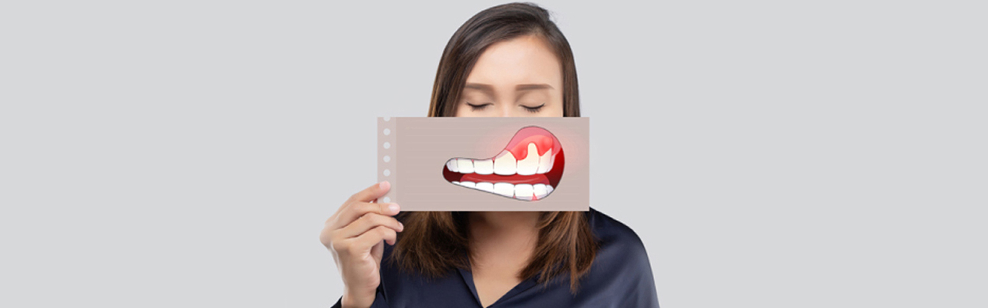 The Relationship Between Gum Ailments and Total Well-being: Grasping the Association