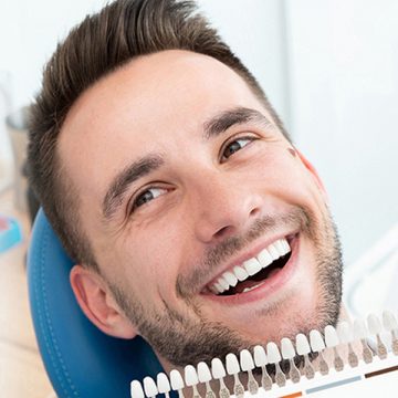 Navigating Veneer Costs: A Comprehensive Guide to Dental Veneers