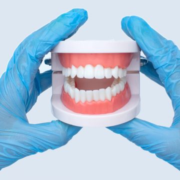 What is the difference between an overdenture and an immediate denture?