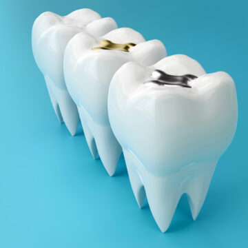 A Comprehensive Guide to Natural-Looking Dental Restorations