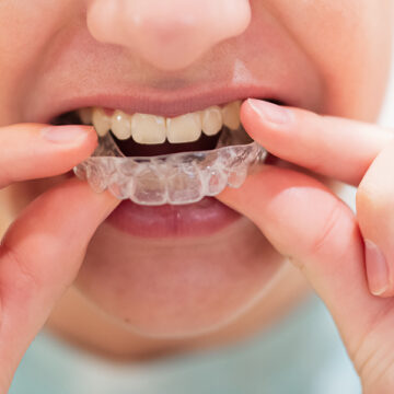 Can Invisalign Fix Gaps in Your Teeth?
