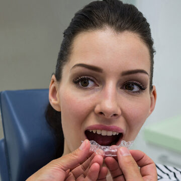 Understanding When You Need Invisalign: Benefits and Treatment Process