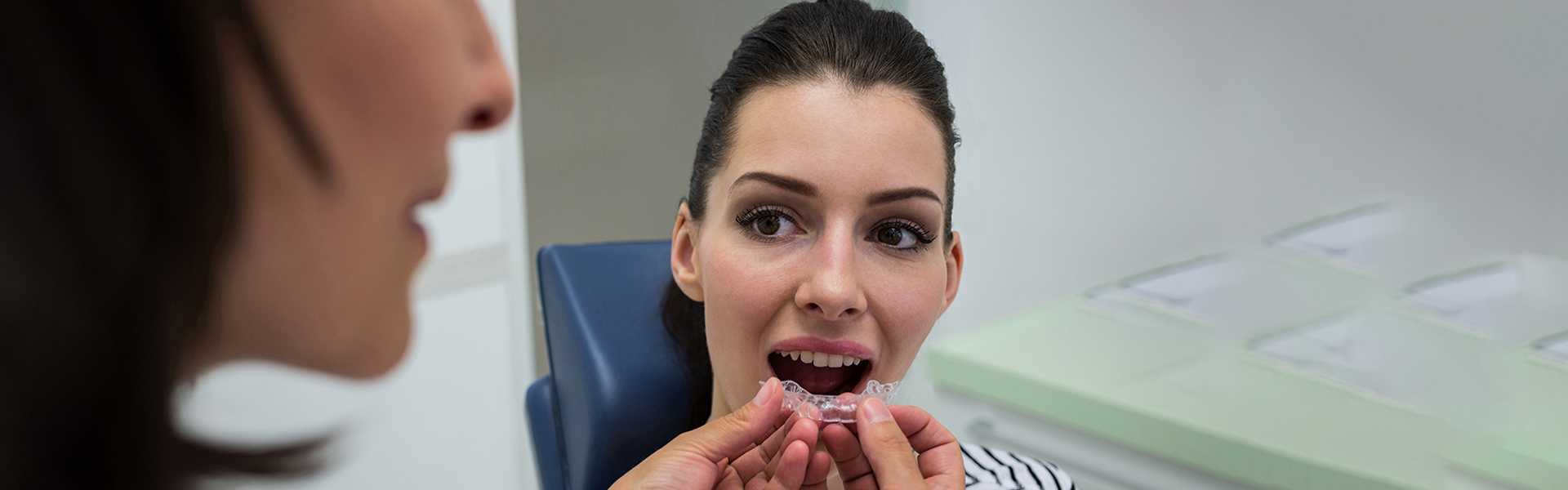 Understanding When You Need Invisalign: Benefits and Treatment Process